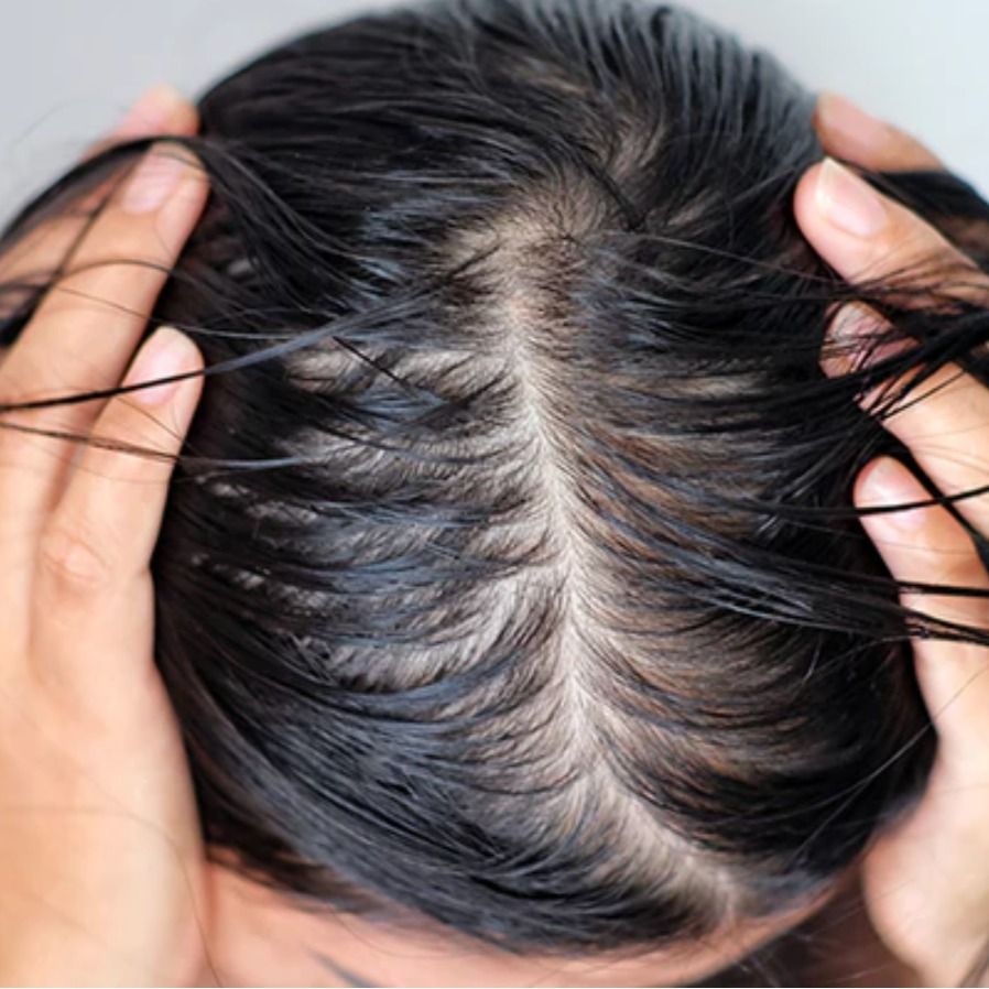 Tóc bết dầu ở vùng chân tóc