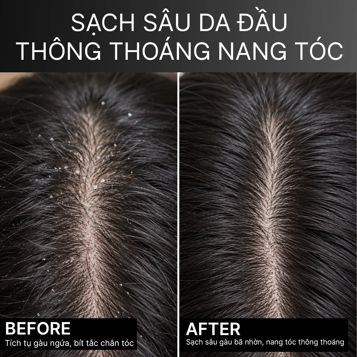 Divaren Scalp Clear Active Shampoo
