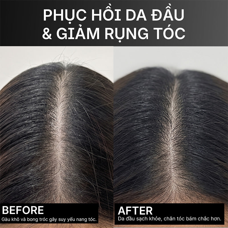 Kết quả trước và sau khi dùng tinh chất Divaren Scalp Density Essence