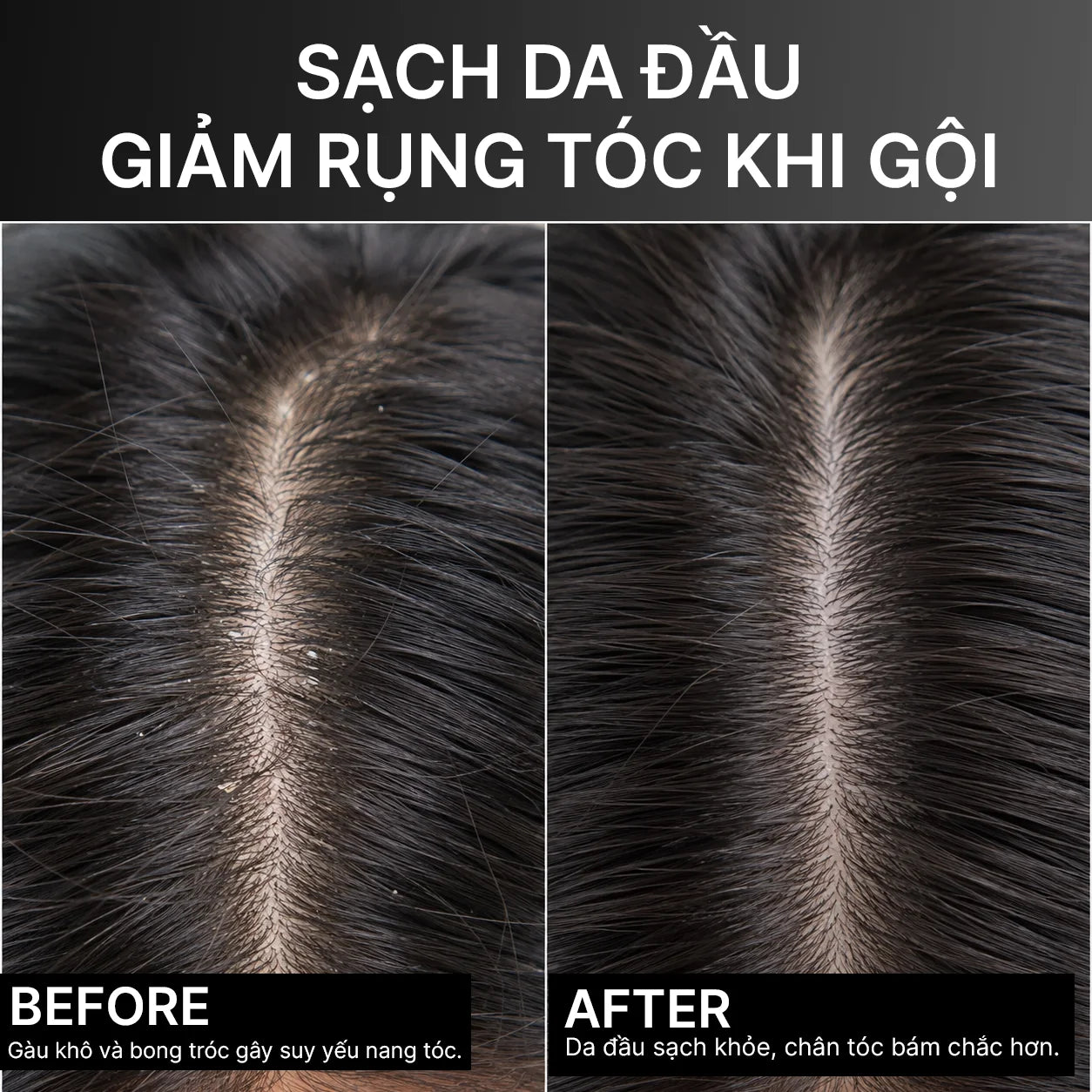 Divaren Scalp Density Essence