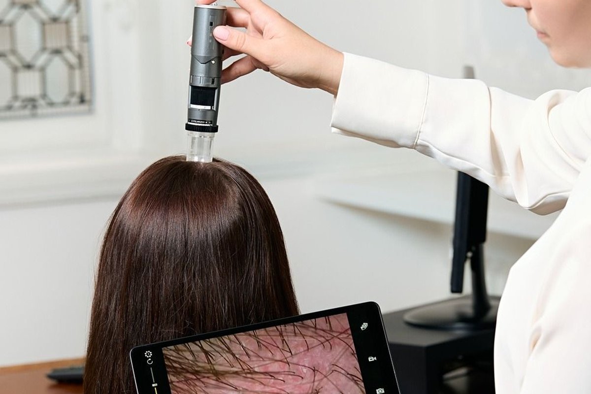 Bác sĩ da liễu soi và khám da đầu