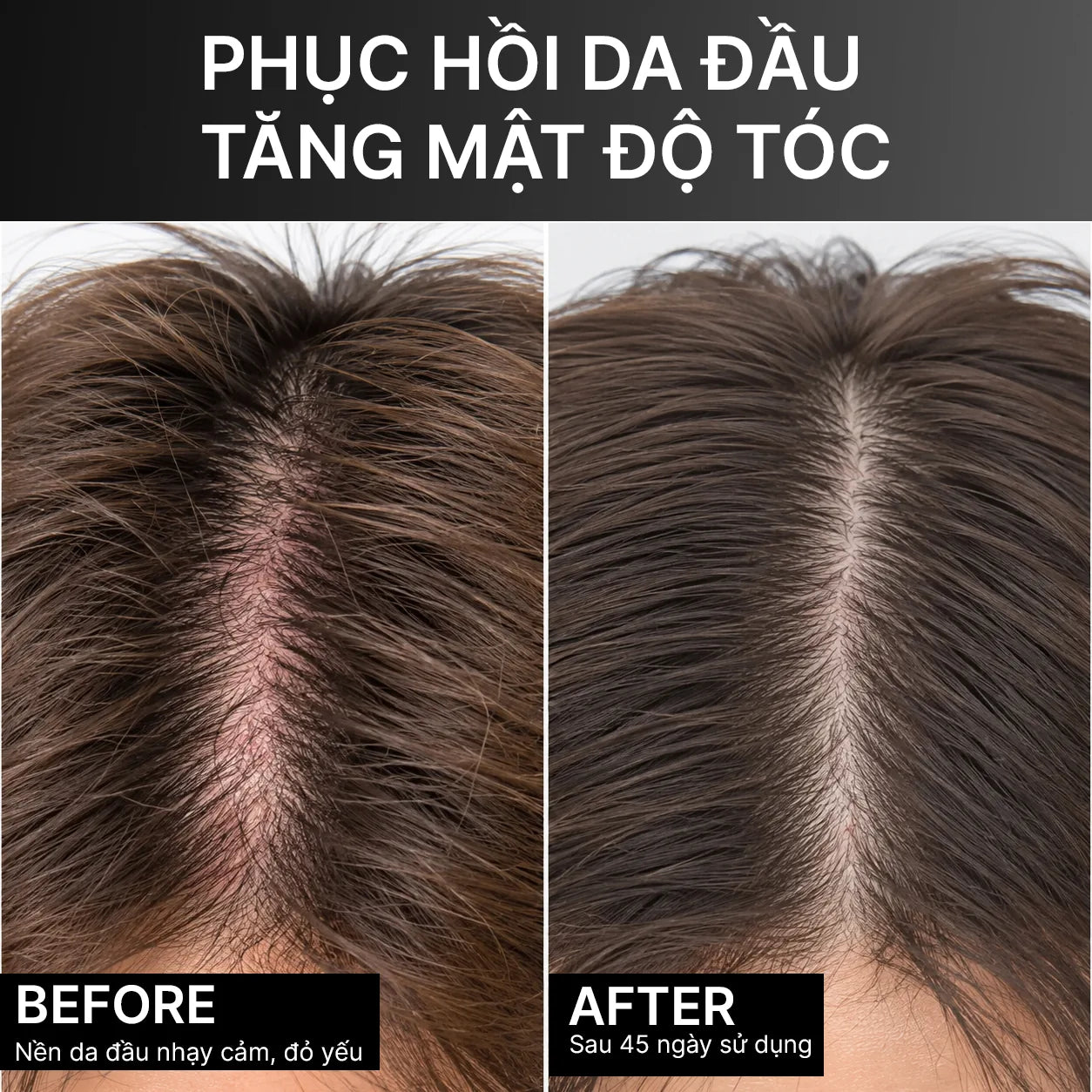 Divaren Scalp Density Root Serum